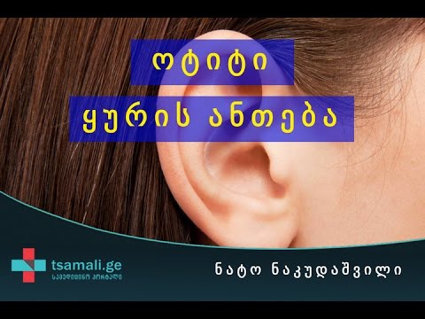 ოტიტი - ყურის ანთება, საუბრობს ოტორინოლარინგოლოგი ნატო ნაკუდაშვილი