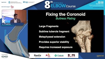 Transolecranon fracture dislocation. Tips and tricks, J. Phadnis