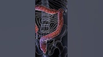 Understanding Diarrhea: Causes, Symptoms, and Management  #anatomy #meded #3danimation