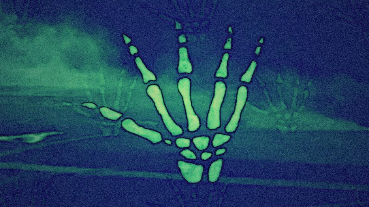 The Backhomes - Solid Gold (Official Video)