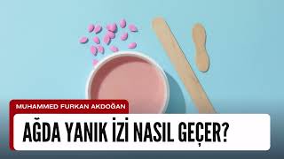 Ağda Yanık İzi Nasıl Geçer?