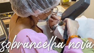 MINHA EXPERIÊNCIA DE REMOÇÃO DE MICROPIGMENTAÇÃO A LASER | Despigmentação de Sobrancelha