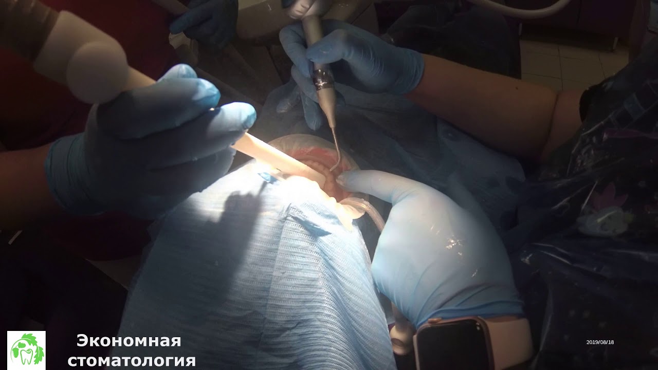 Комплексная гигиена полости рта Air Flow