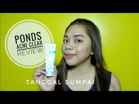 Ponds Acne Clear (Anti Acne Facial Wash) Review
