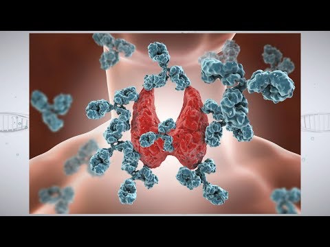 Video: Autoimmun Thyroiditis - Behandling Af Autoimmun Thyroiditis Med Folkemæssige Midler Og Metoder