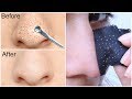 Easy DIY BLACKHEAD Remover Peel Off Mask - INSTANT RESULTS | Anaysa