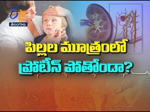 Nephritic Syndrome In Children | Sukhibhava | 2nd August 2019 | ETV Telangana