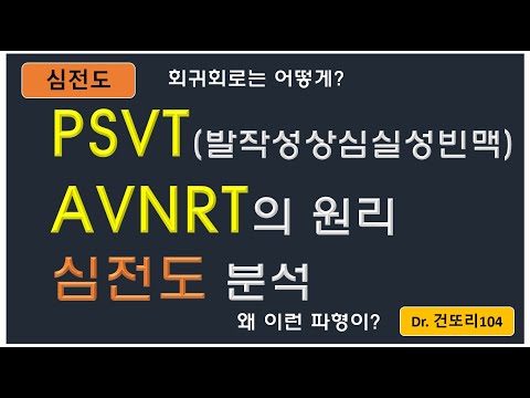 PSVT(발작성상심실성빈맥)-AVNRT(방실결절회귀성빠른맥) 원리와 심전도 이해