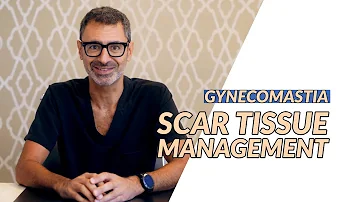 Scar tissue management post Gynecomastia surgery with Dr. Dadvand.