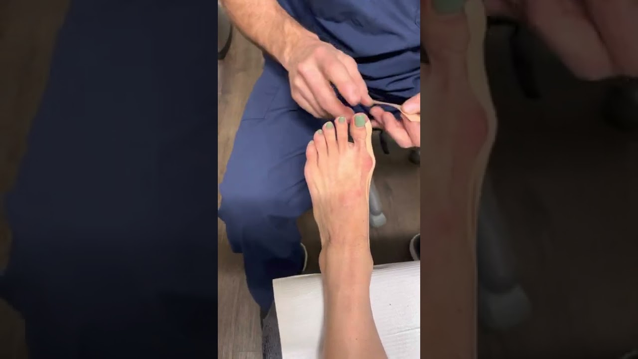 Turf toe - Physiopedia