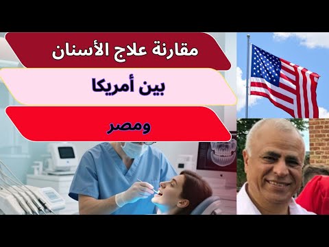        مقارنة بين تكاليف علاج الأسنان في مصر وأمريكا