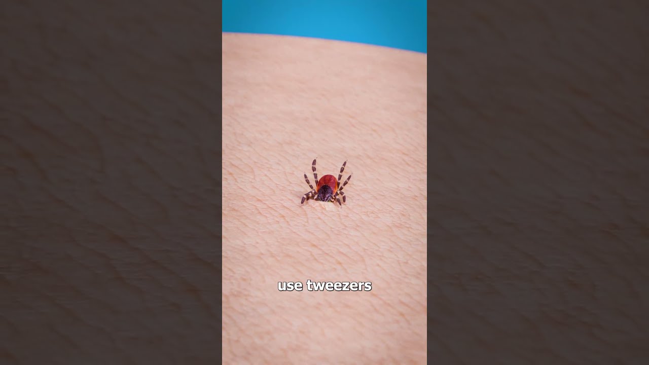 How To Remove A Tick 