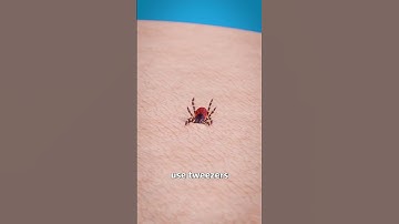 Thumbnail of How To Remove A Tick 🤢