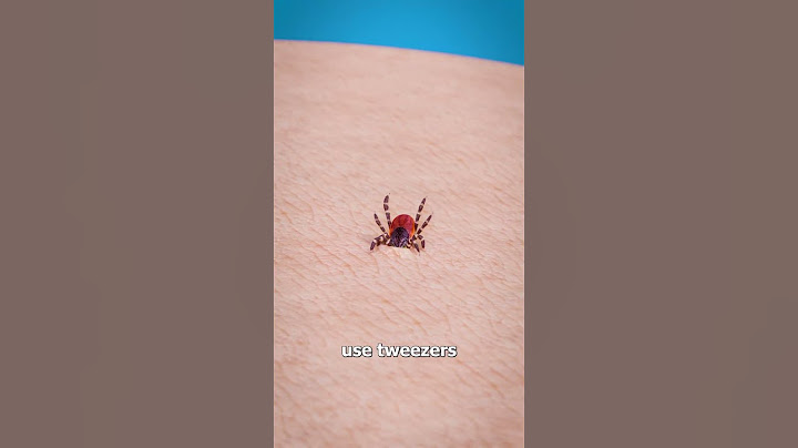 How To Remove A Tick 🤢