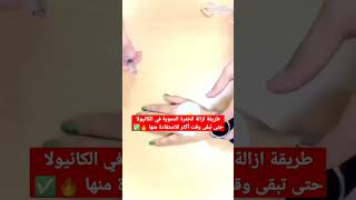 طريقة ازالة الخثرة الدموية في الكانيولا حتى تبقى وقت أكثر للاستفادة منها 🔥✅