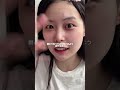 Cure Acne Super Fast‼️ Acne Skincare Numbersin Cure Acne Super Fast‼️ Acne Skincare Numbersin