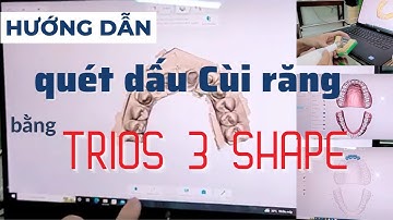 Hướng dẫn quét dấu Mão / Cầu Răng Sứ  bằng 3 Shape Trios #eden #hướngdẫn #hoàiân