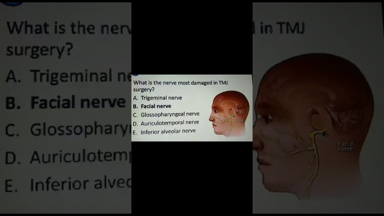 Multiple choice questions in oral surgery YouTube