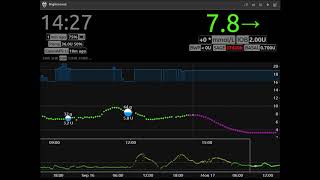 Androidaps 5Hrs In A Minute
