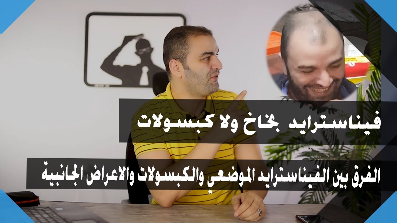 الفرق بين فيناسترايد موضعي و كبسولات لمحاربة الصلع الوراثي