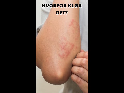 Video: Hvorfor klør vulvovaginitt?