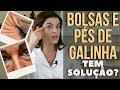 BOLSAS NOS OLHOS e PÉS DE GALINHA - Tem Solução?