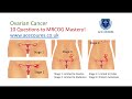 Ovarian Cancer for the MRCOG Exam. MRCOG Mastery in 10 Questions.