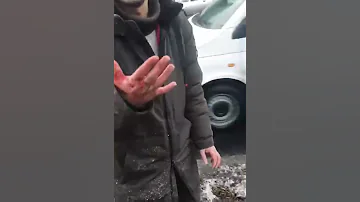 Авария на Ландау, человеку оторвало голову. 18+