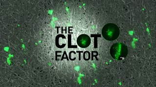 The Clot Factor | Full Measure