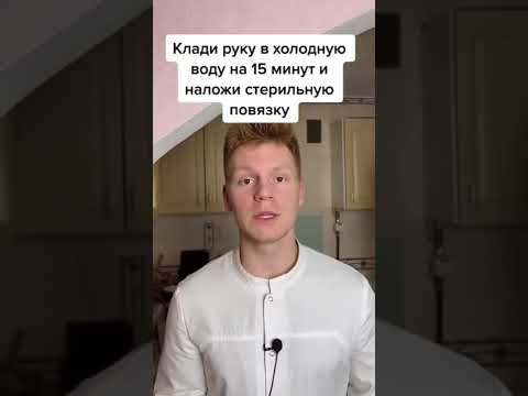 Что делать если получил ожог?