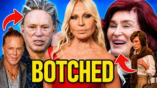 Celebrities Who Ruined Their Faces With Botched Surgery