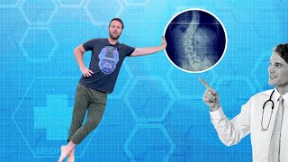 How I Healed My Scoliosis and Chronic Back Pain