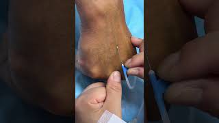 Intramuscular Injection Technique Explained | Safe IM Injection Step-by-Step | Nurse Guide Class 33