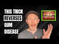 How to Reverse Gum Disease at Home