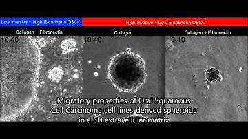 Fibronectin Modulates Cell Adhesion and Signaling to Promote Single Cell Migration of Highly