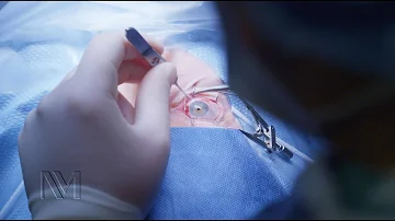 Can you go blind from Strabismus surgery?