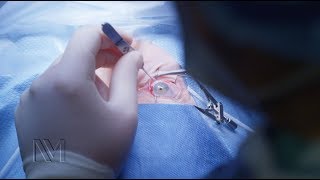 Strabismus Eye Surgery | Inside the OR