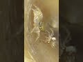 This spider was living in a woman's ear for 4 days