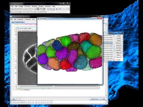 Video: 3DMMS: Robust 3D Membrane Morfological Segmentation Of C. Elegans Embryo