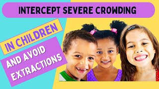 Intercept Severe Crowding In Children And Avoid Extractions
