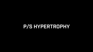 P/S Hypertrophy