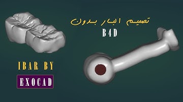 شرح تصميم تركيبات على بار باستخدام اكسوكاد فقط | بدون b4d  | zircon + bar just exocad