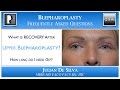 What is the Recovery after Upper Blepharoplasty? How long will I need off work after an eyelid lift?