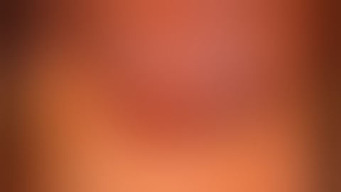 Laparoscopic Appendectomy for Chronic Appendicitis, Difficult Appendix .