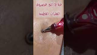 علاج ألم غضروف الفقرات القطنية ️