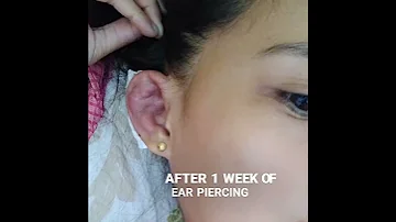 Very Painful INFECTED EAR PIERCING 