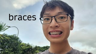 my new braces (unboxing + review)