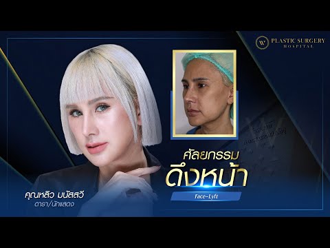 "ผลลัพธ์หลังดึงหน้า 11 วัน ของคุณหลิว มนัสสวี ‼ เรื่องดึงหน้า แก้ไขให้ตรงจุด หลิวมั่นใจ