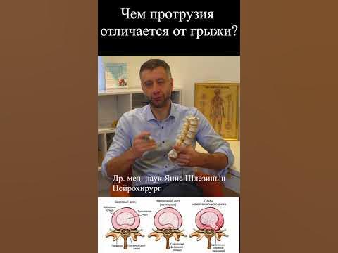 Чем протрузия отличается от грыжи? - YouTube