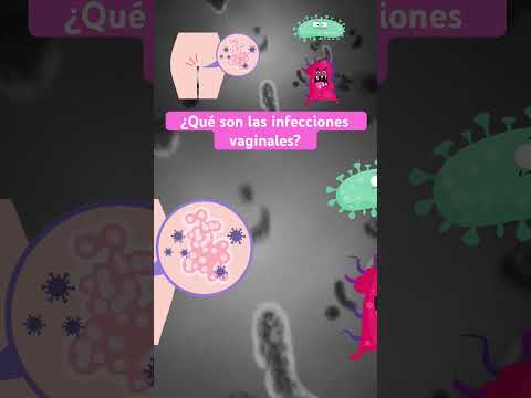✨¿Qué son las